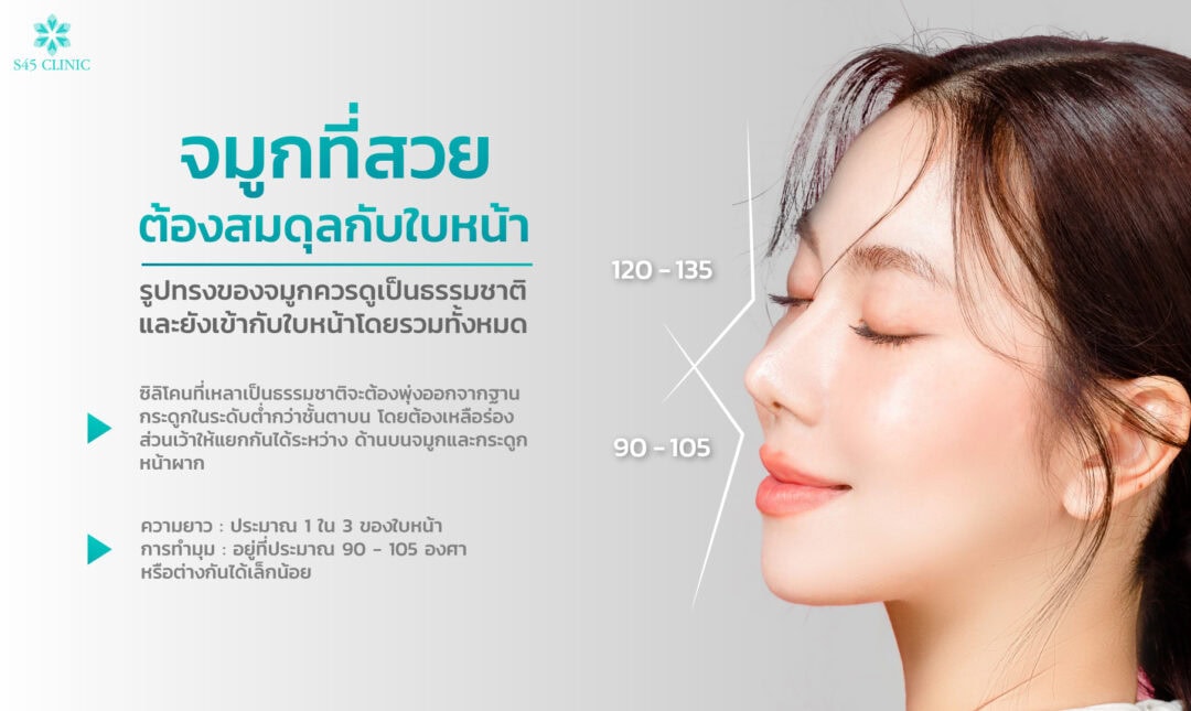 ข้อดีของการเสริมจมูก open