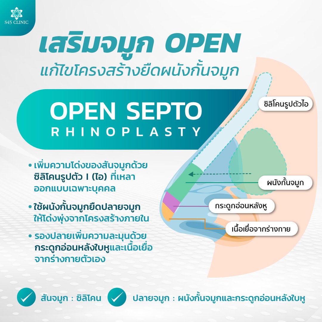 Septor Rhinolasty เสริมจมูกผู้ชาย (Men Nose Surgery) เติมหล่อเพิ่มเสน่ห์