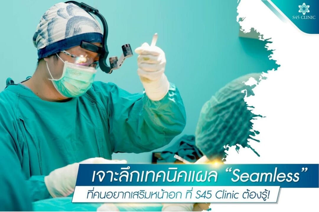 เจาะลึกเทคนิคแผล seamless