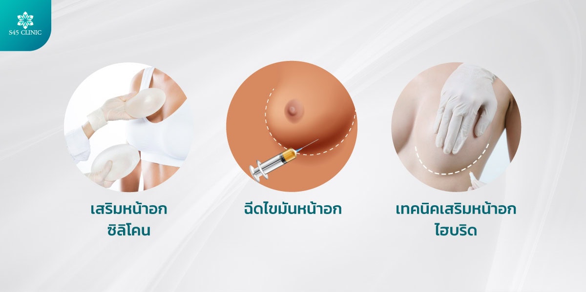 เสริมหน้าอก มีกี่แบบ