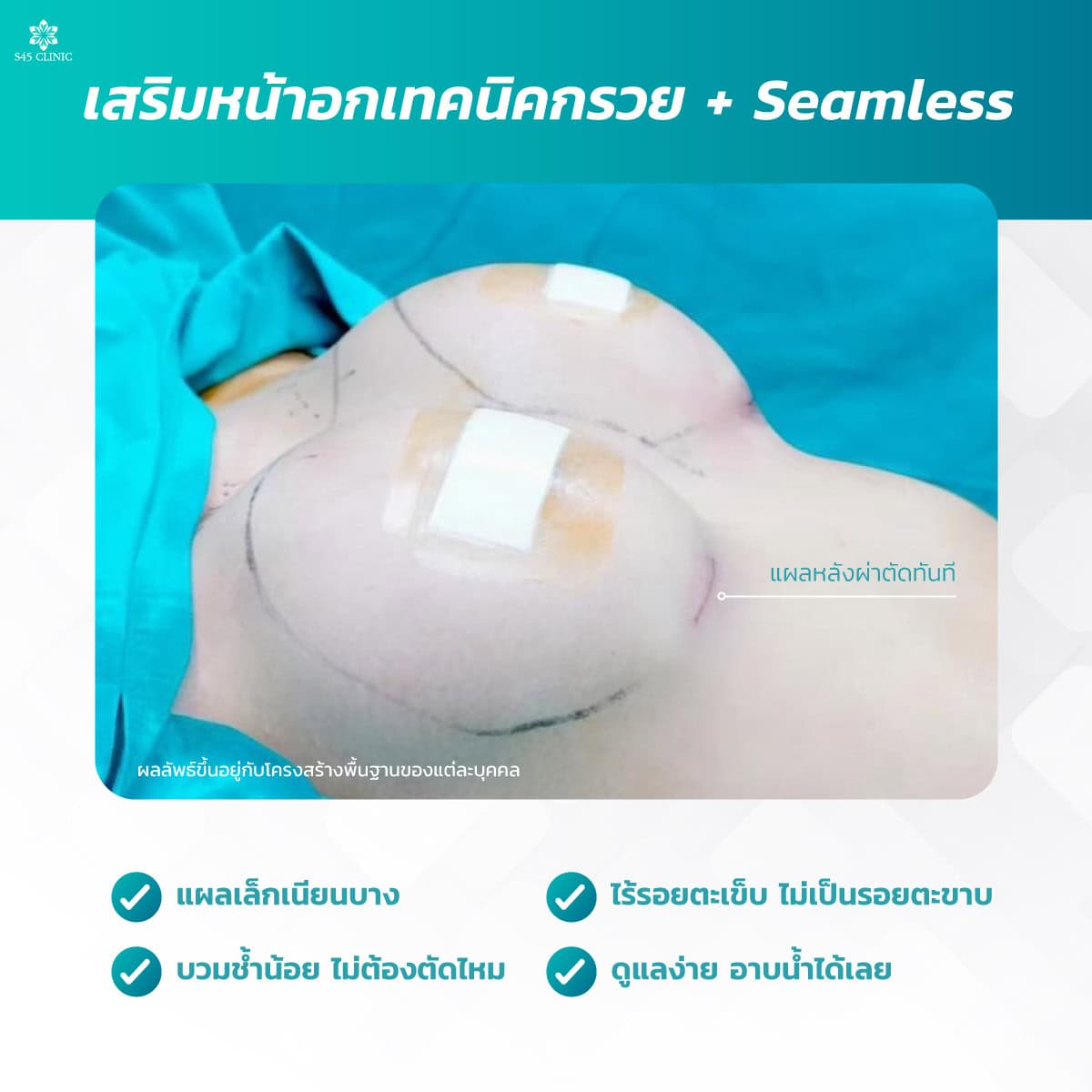 seamless