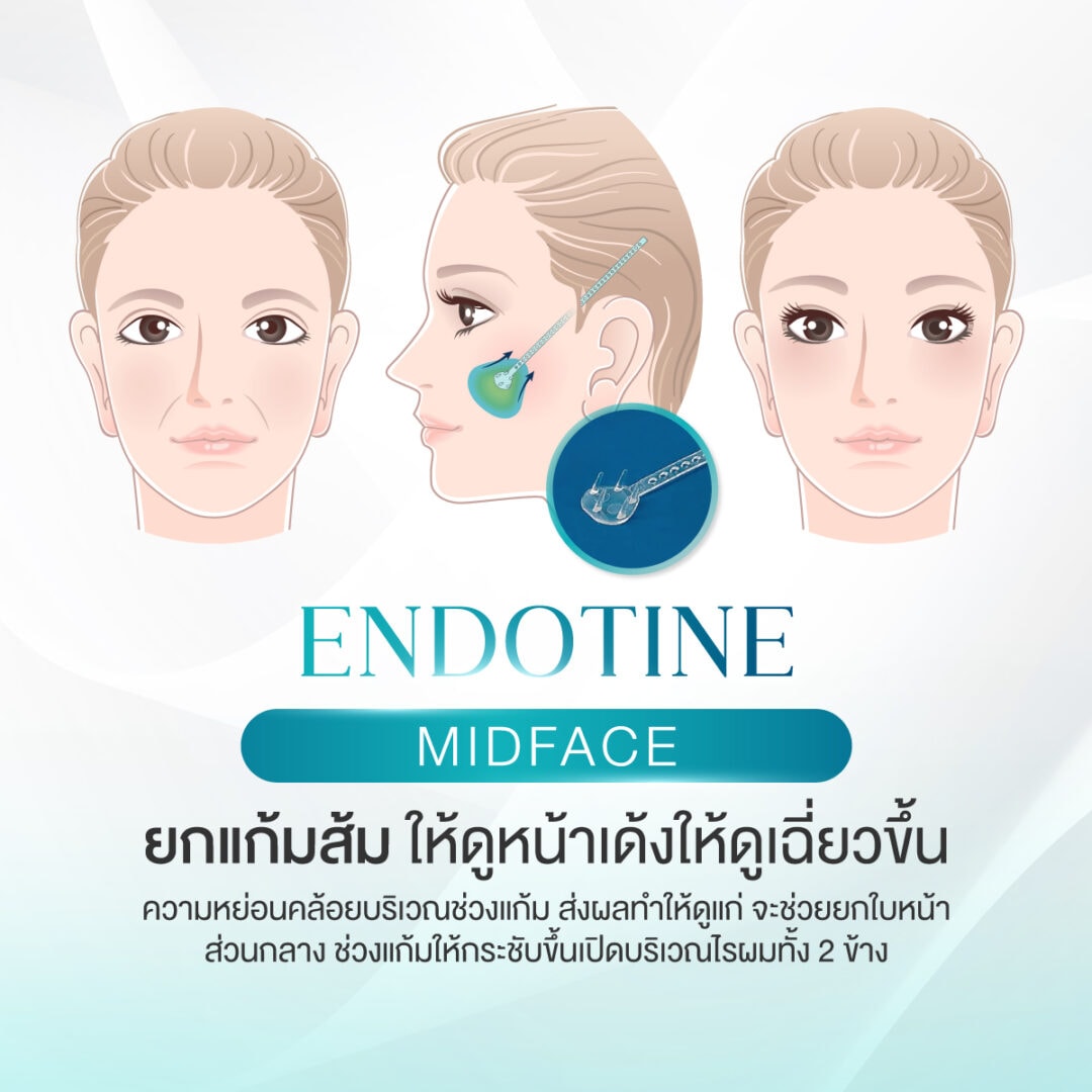เหตุผลที่ควรทำ Endotine ล็อคหน้าให้ ยกกระชับ - s45 clinic