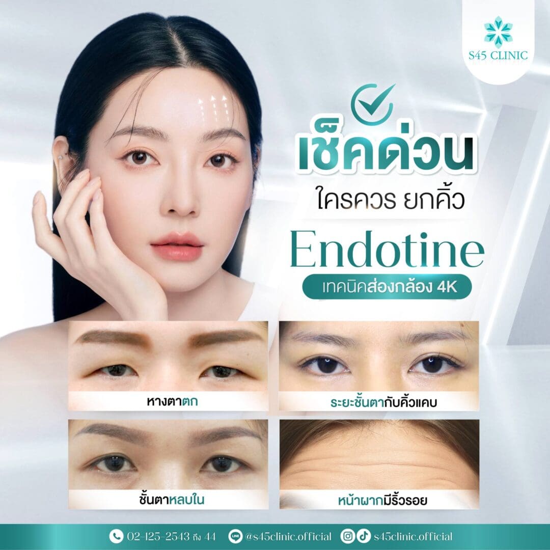 endotine