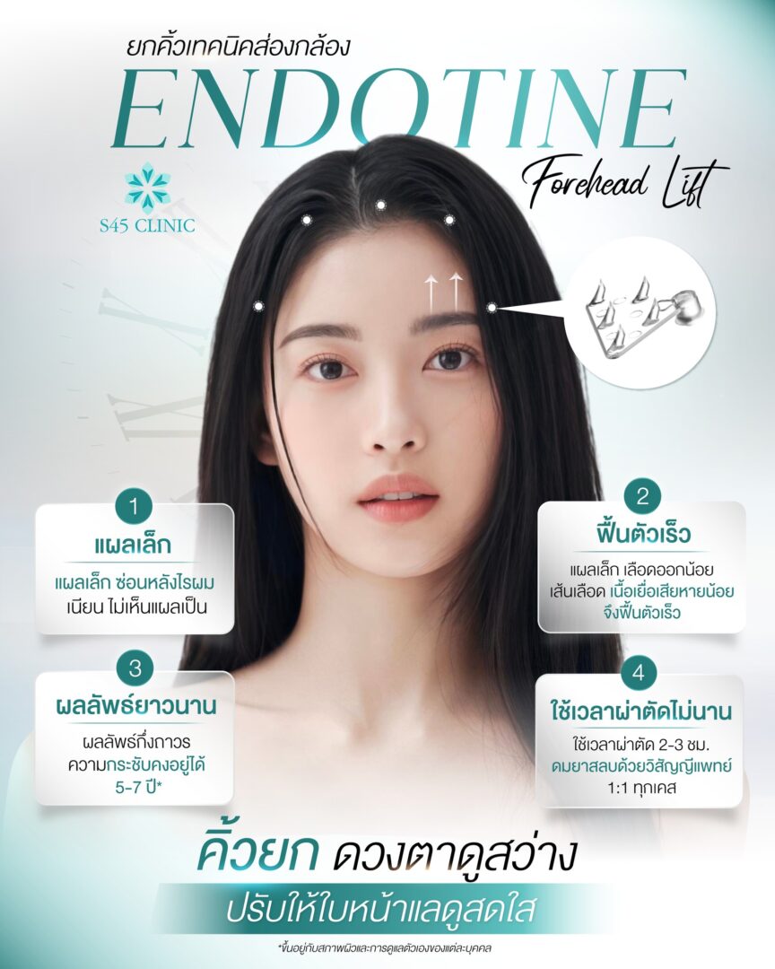 Endotine