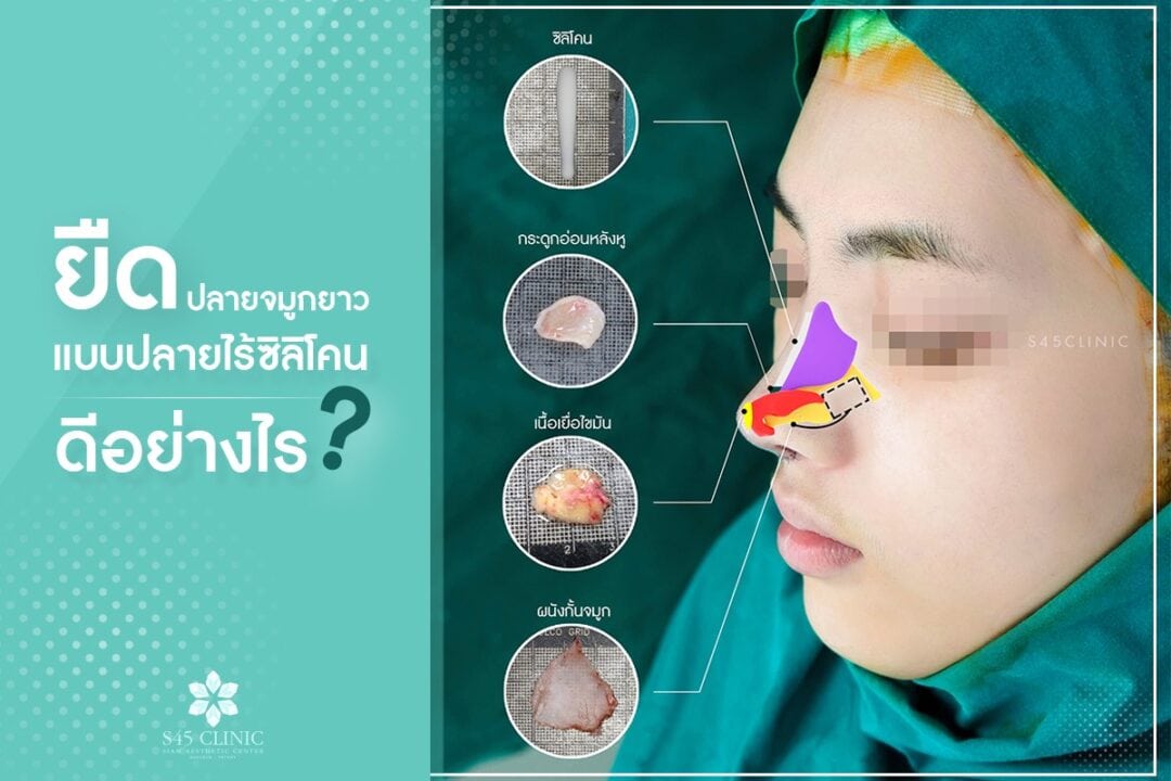 ยืดปลายยาว ไร้ซิลิโคน