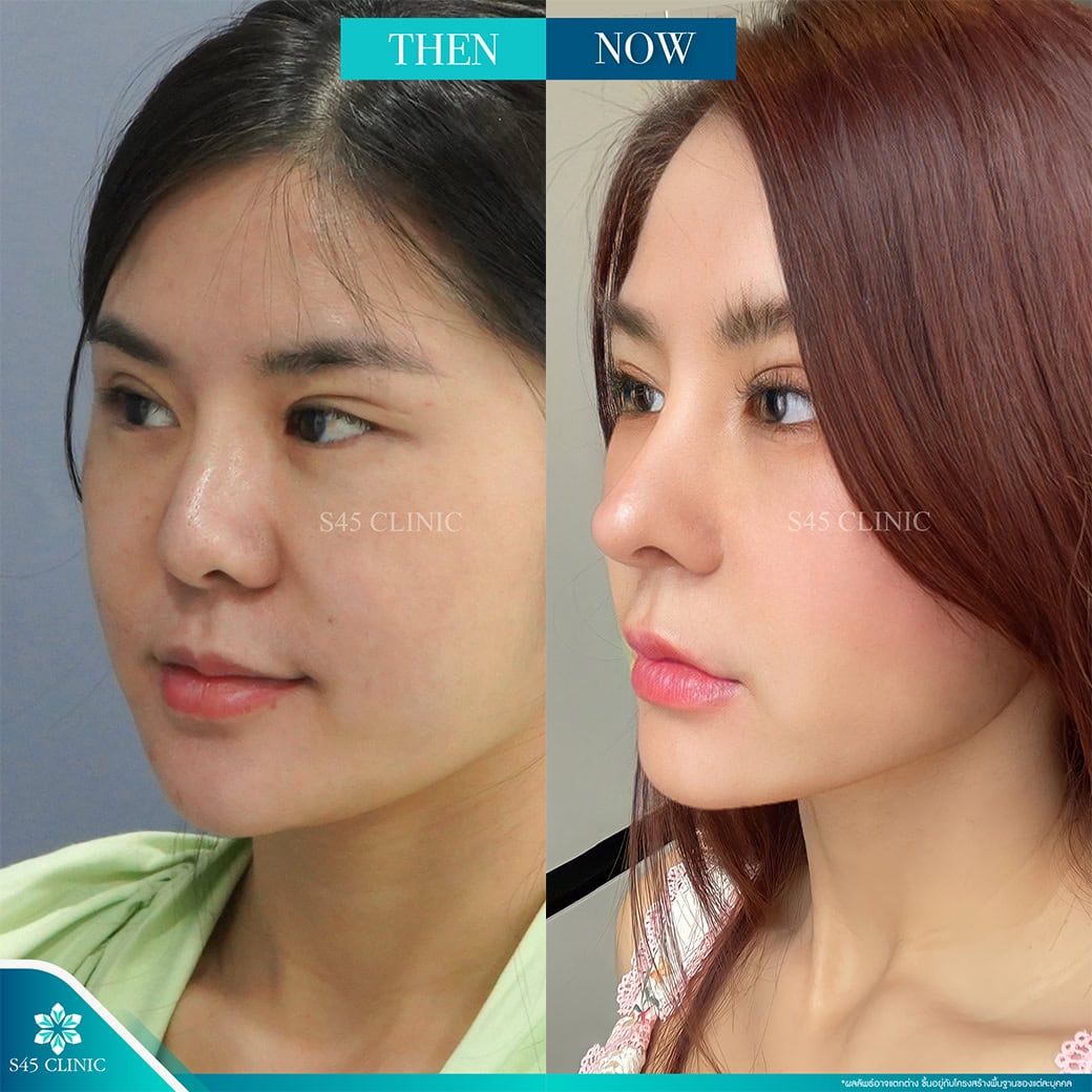 รีวิวหมอจอร์เจีย