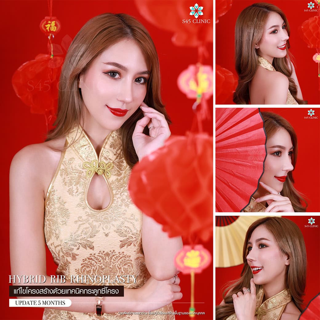 รีวิวหมอวิน
