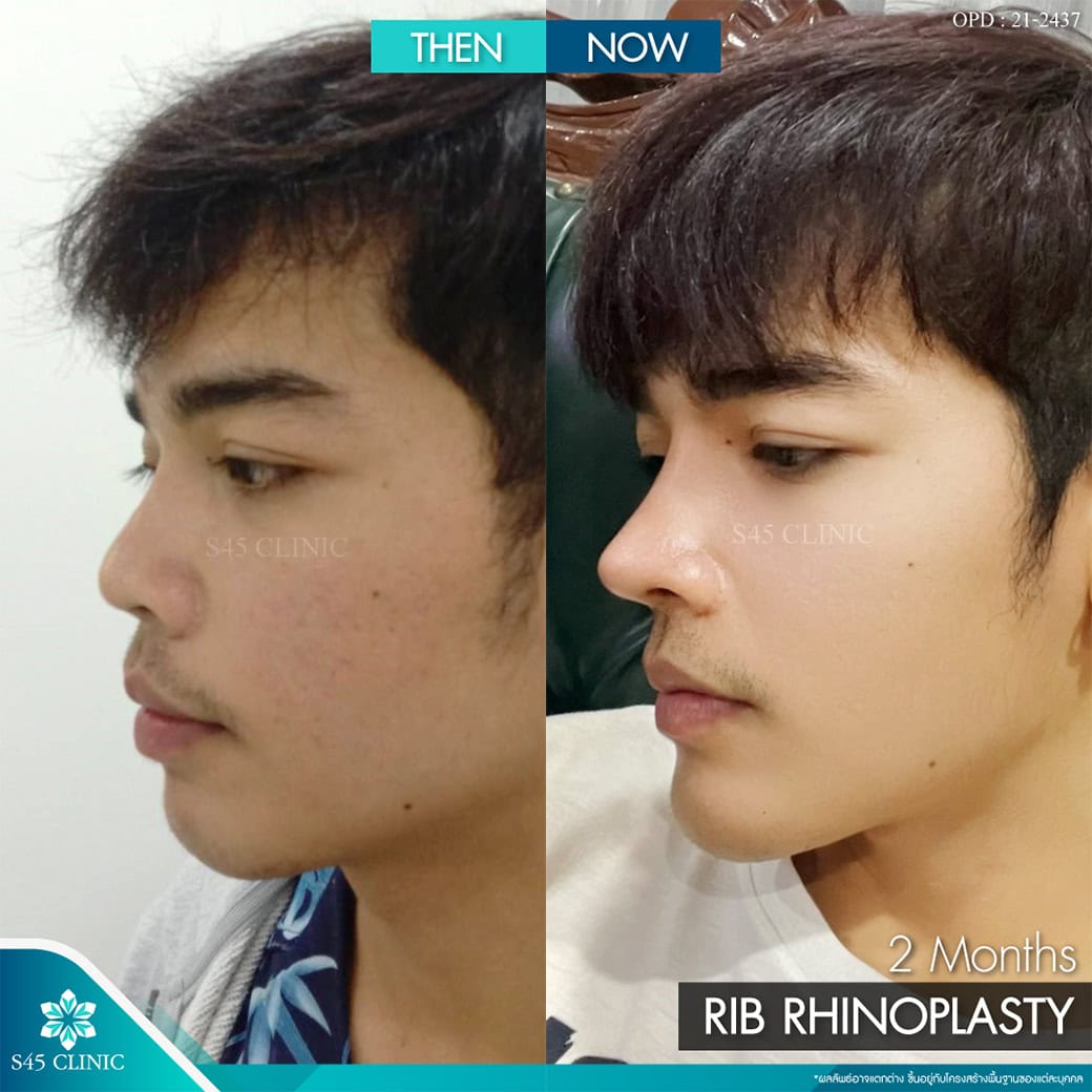 รีวิวหมอจอร์เจีย