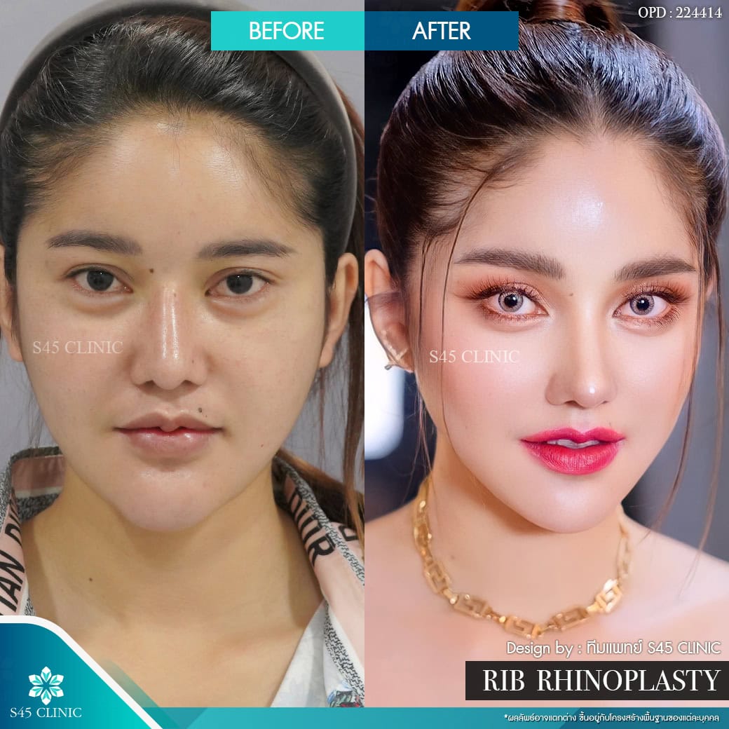 รีวิวหมอจอร์เจีย