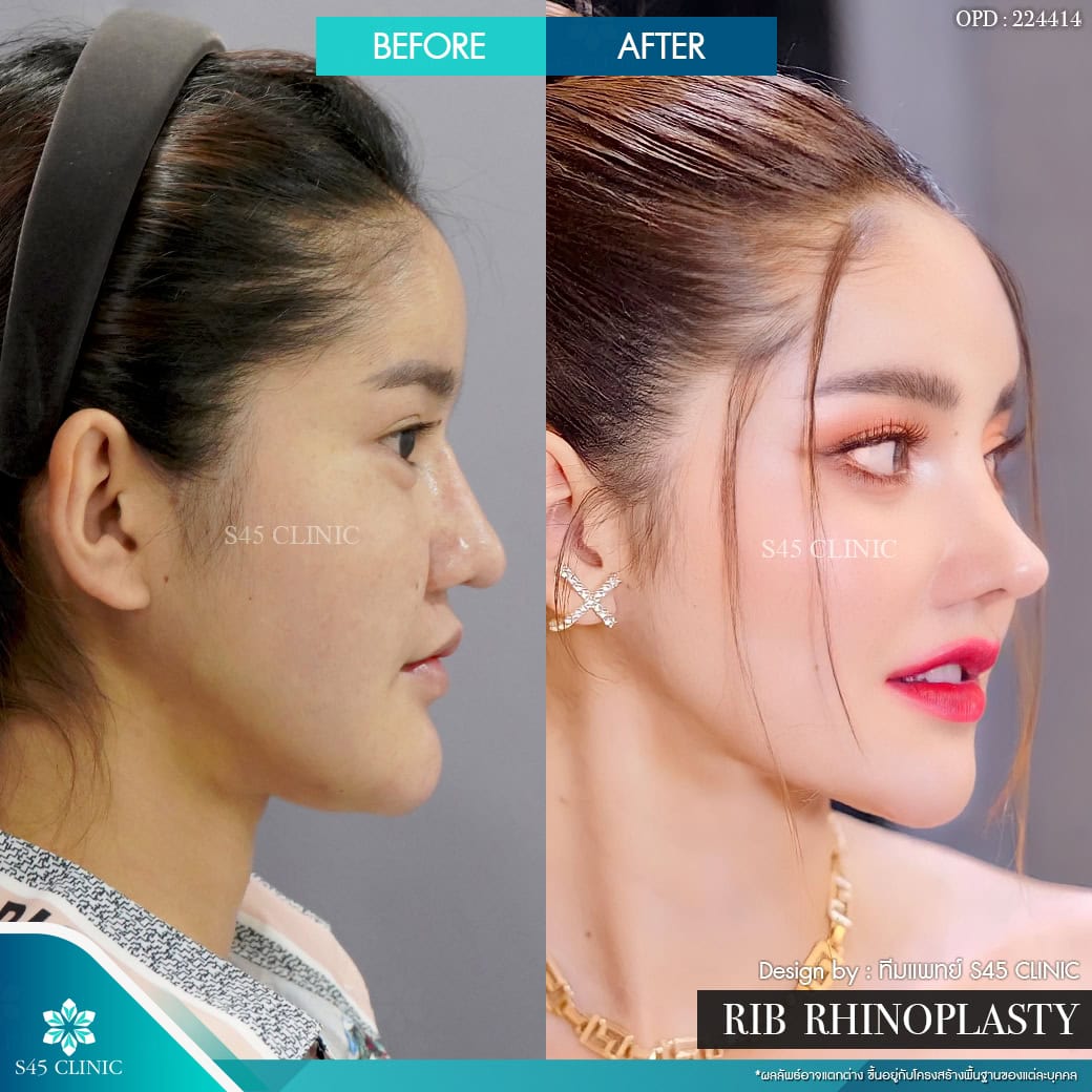 รีวิวหมอจอร์เจีย