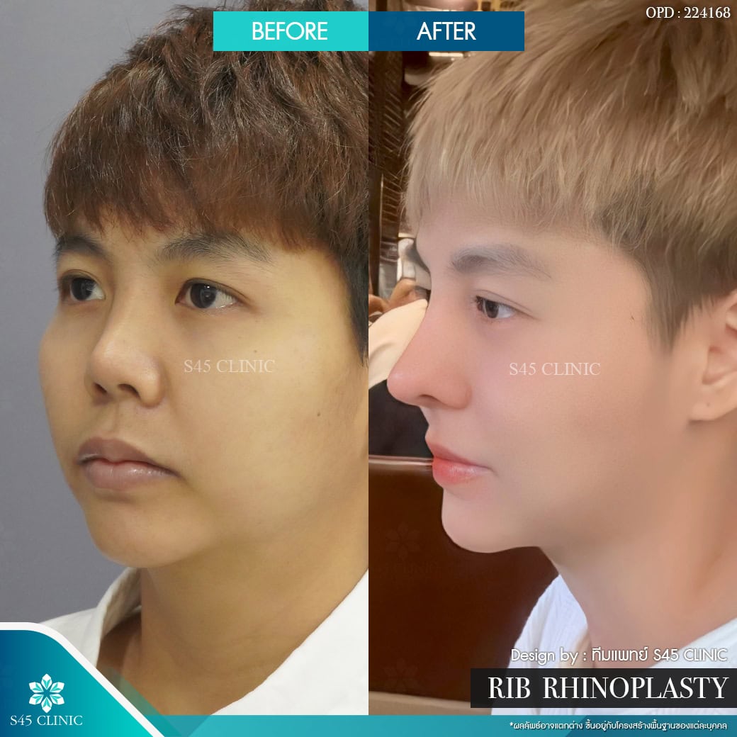 รีวิวหมอจอร์เจีย