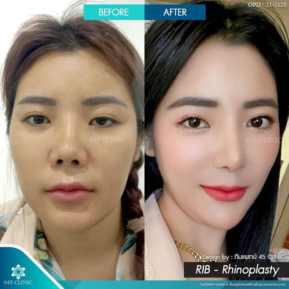 รีวิวหมอจอร์เจีย