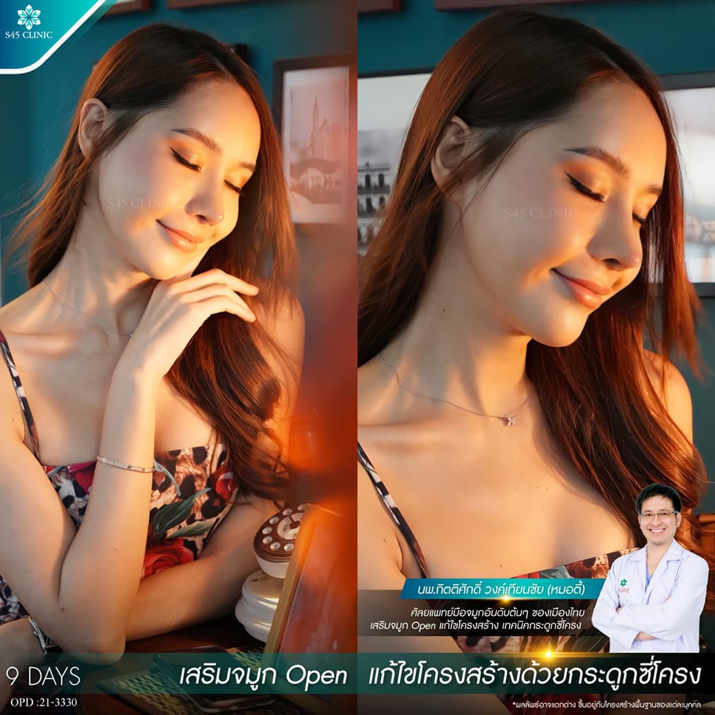 review หมอตี้
