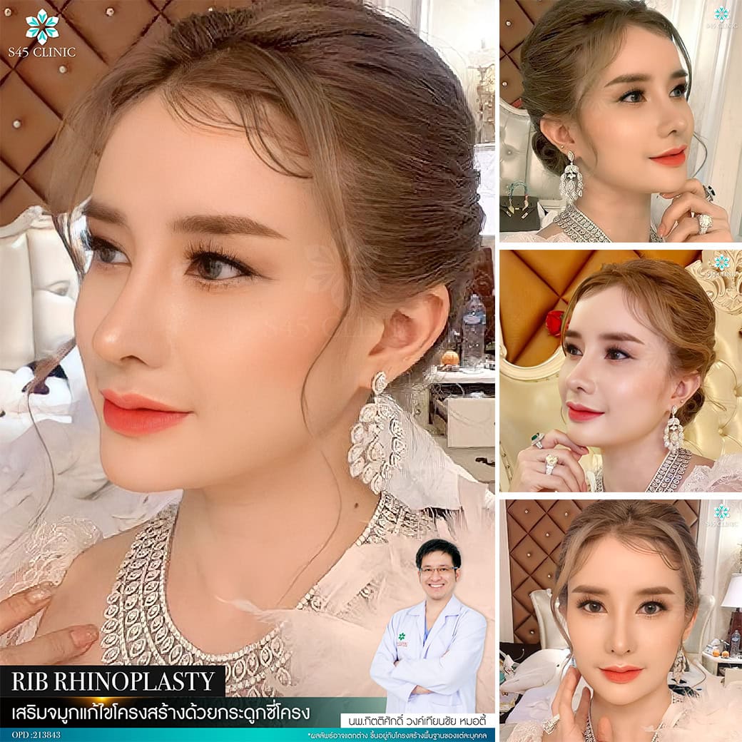 รีวิวหมอตี้