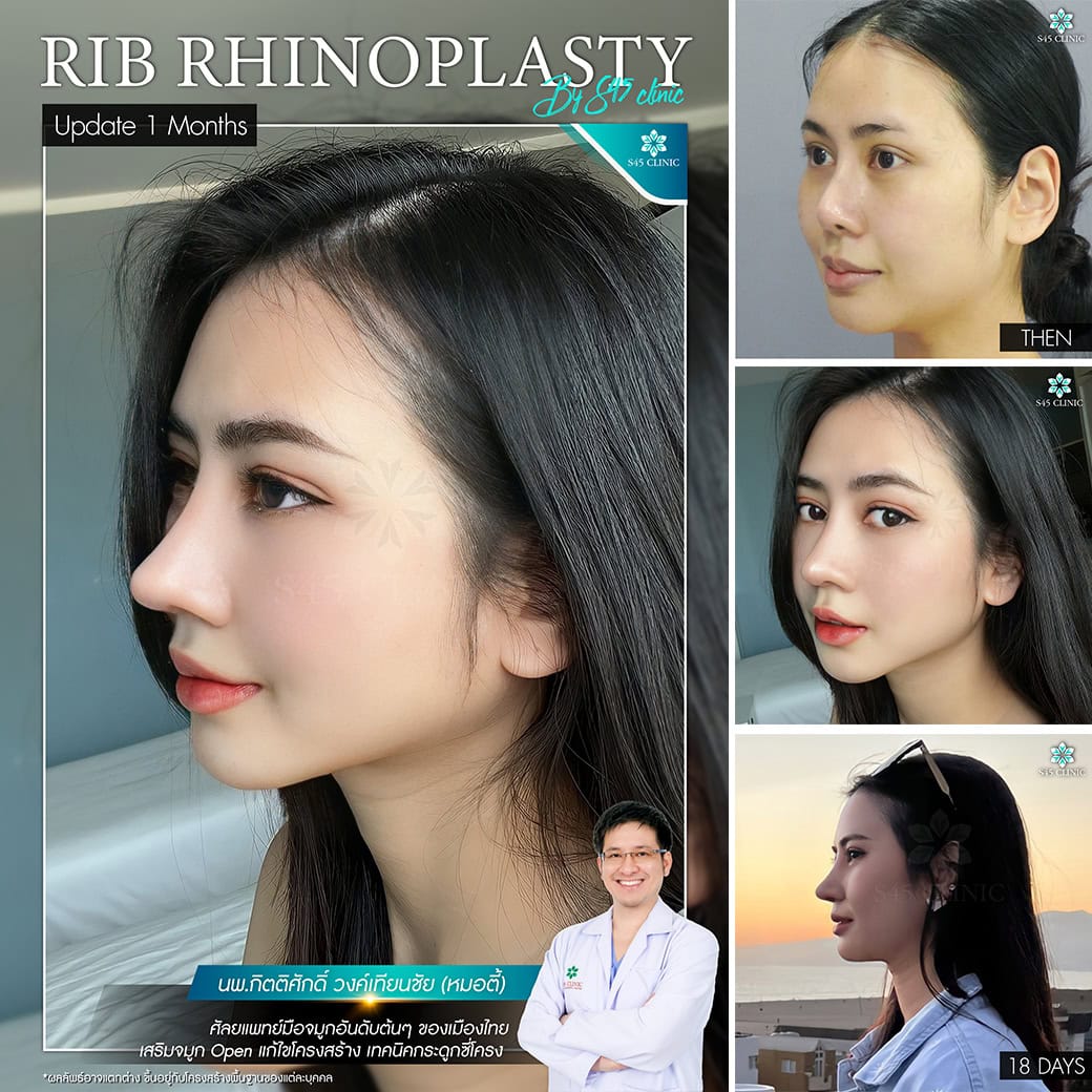รีวิวหมอตี้