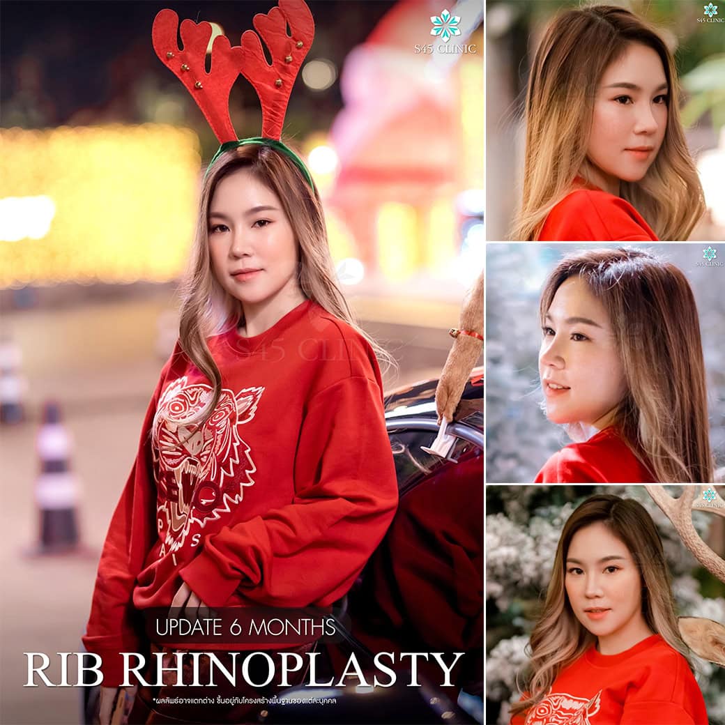 รีวิวหมอตี้