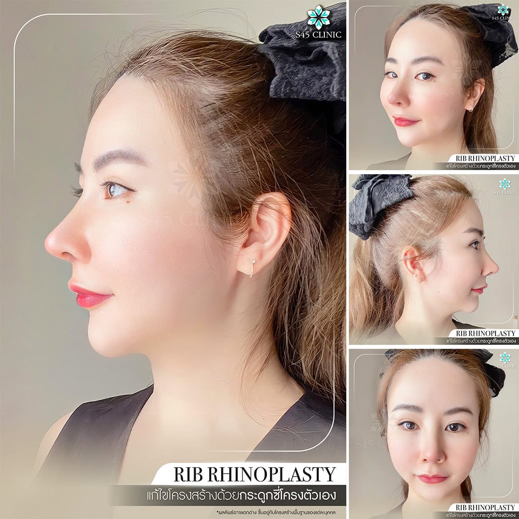 รีวิวหมอตี้