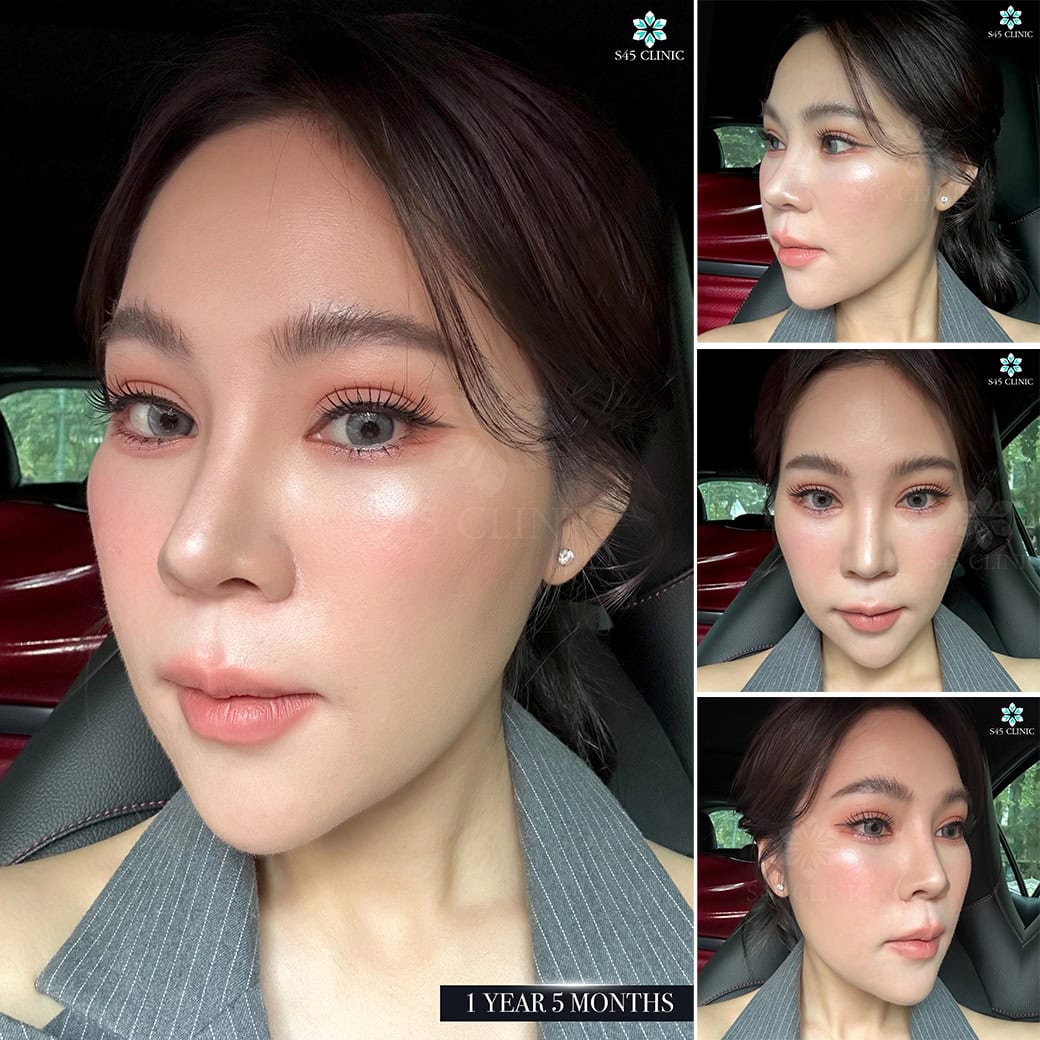 รีวิวหมอตี้