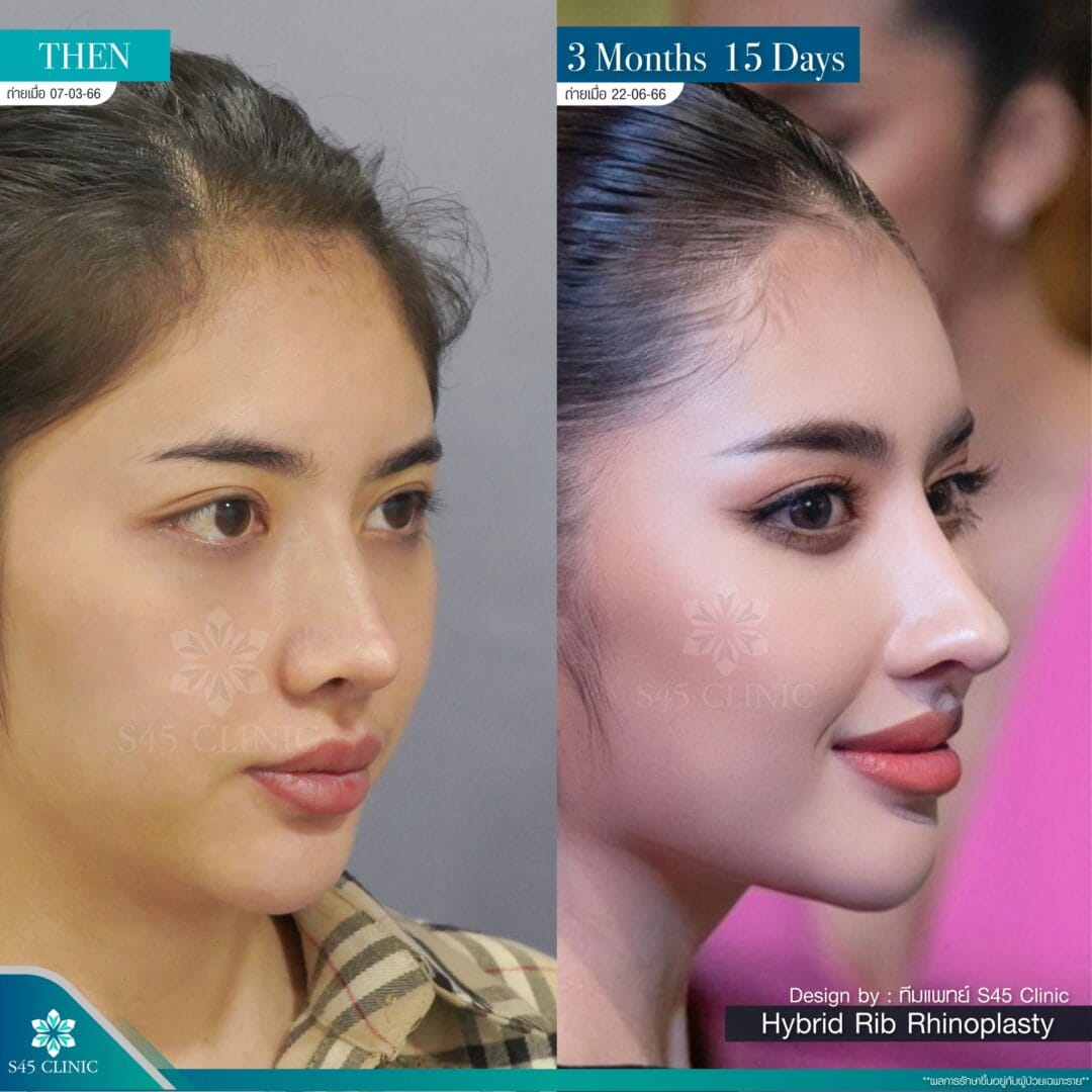รีวิวหมอจอร์เจีย