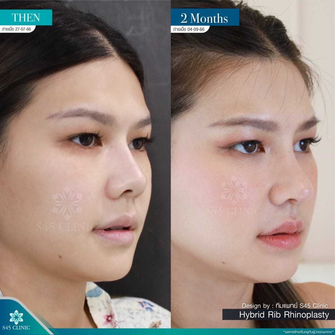 รีวิวหมอจอร์เจีย