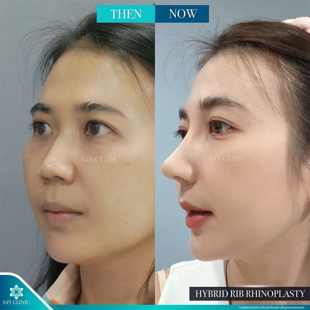 รีวิว หมอวินน์