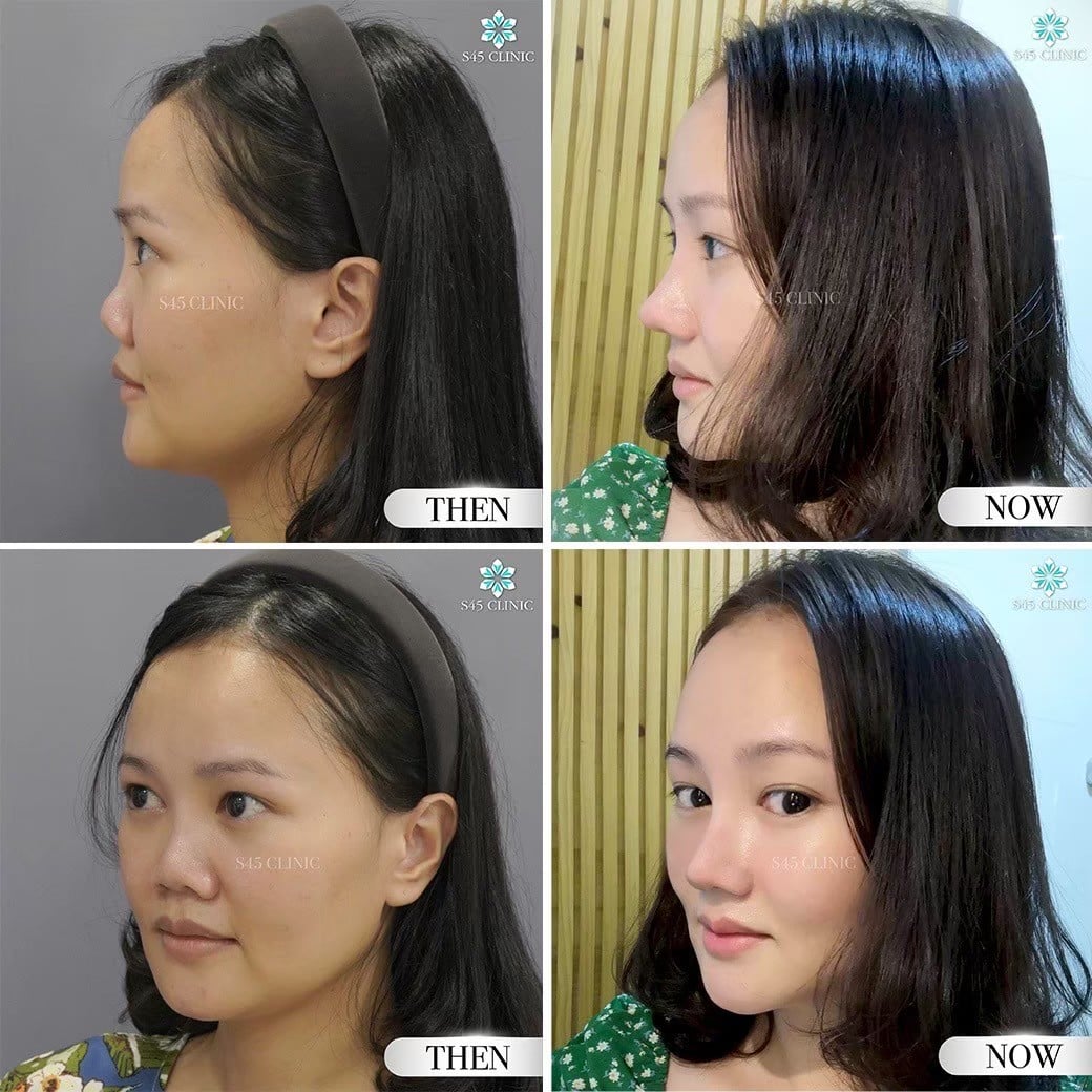 รีวิว หมอวินน์