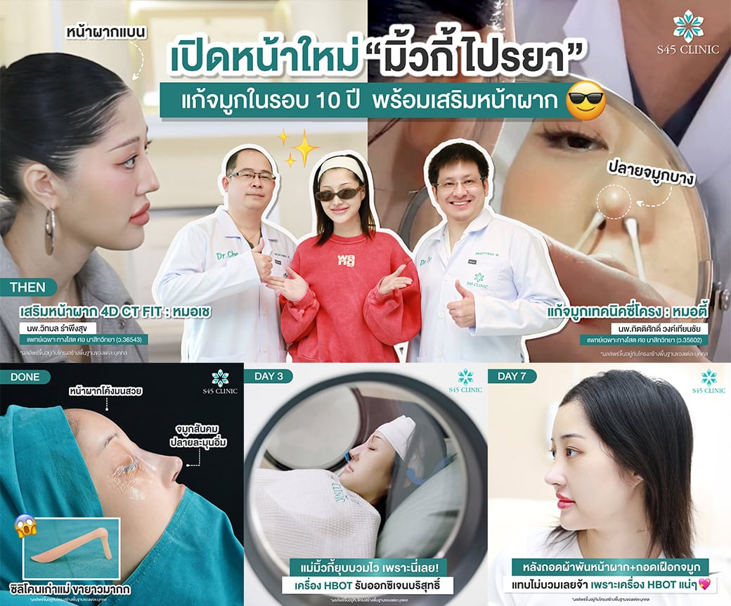 รีวิวหมอตี้