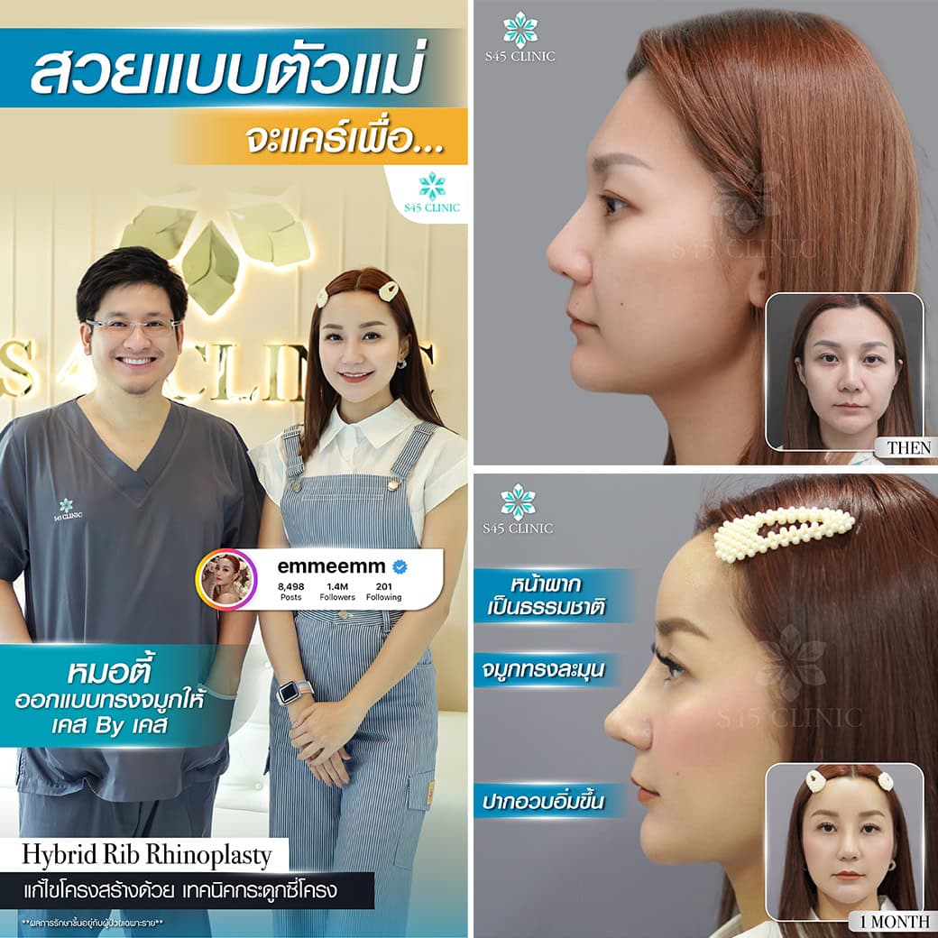 รีวิวหมอตี้