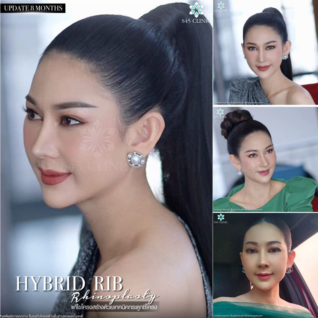 รีวิวหมอตี้