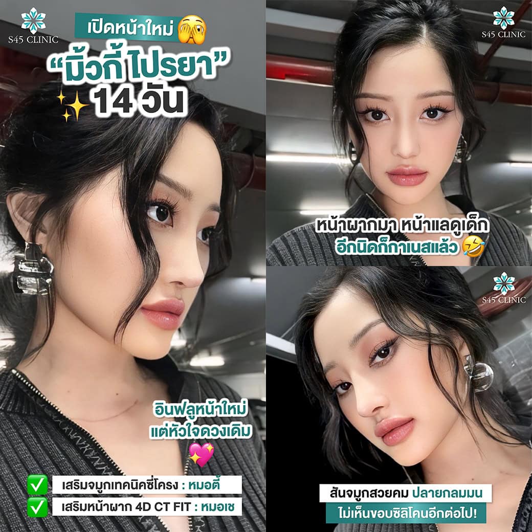 รีวิวหมอตี้