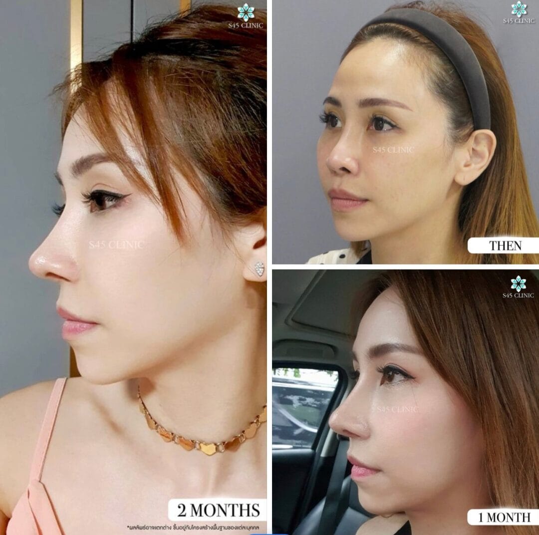 รีวิวหมอตี้