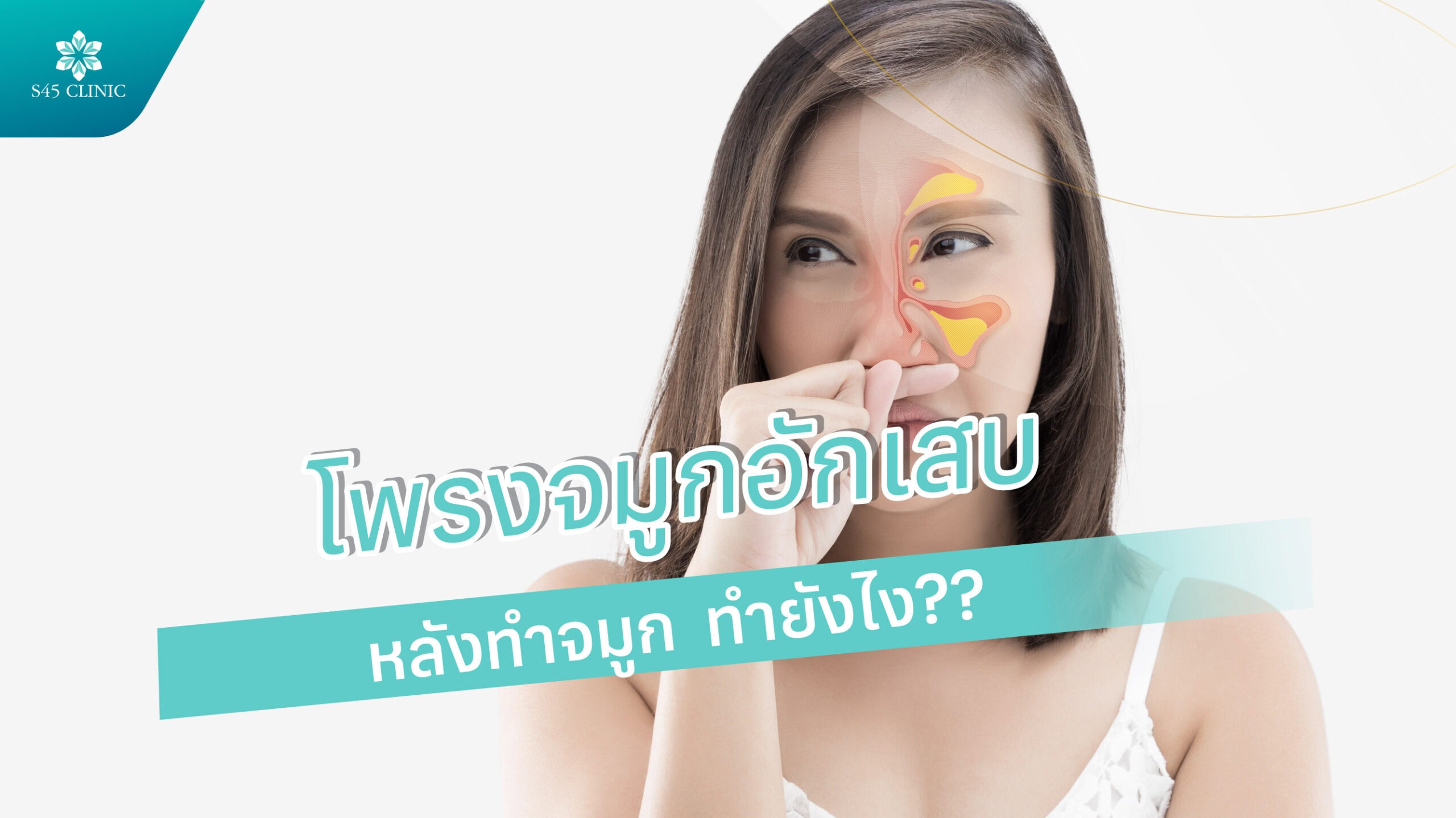 โพรงจมูกอักเสบหลังเสริมจมูก