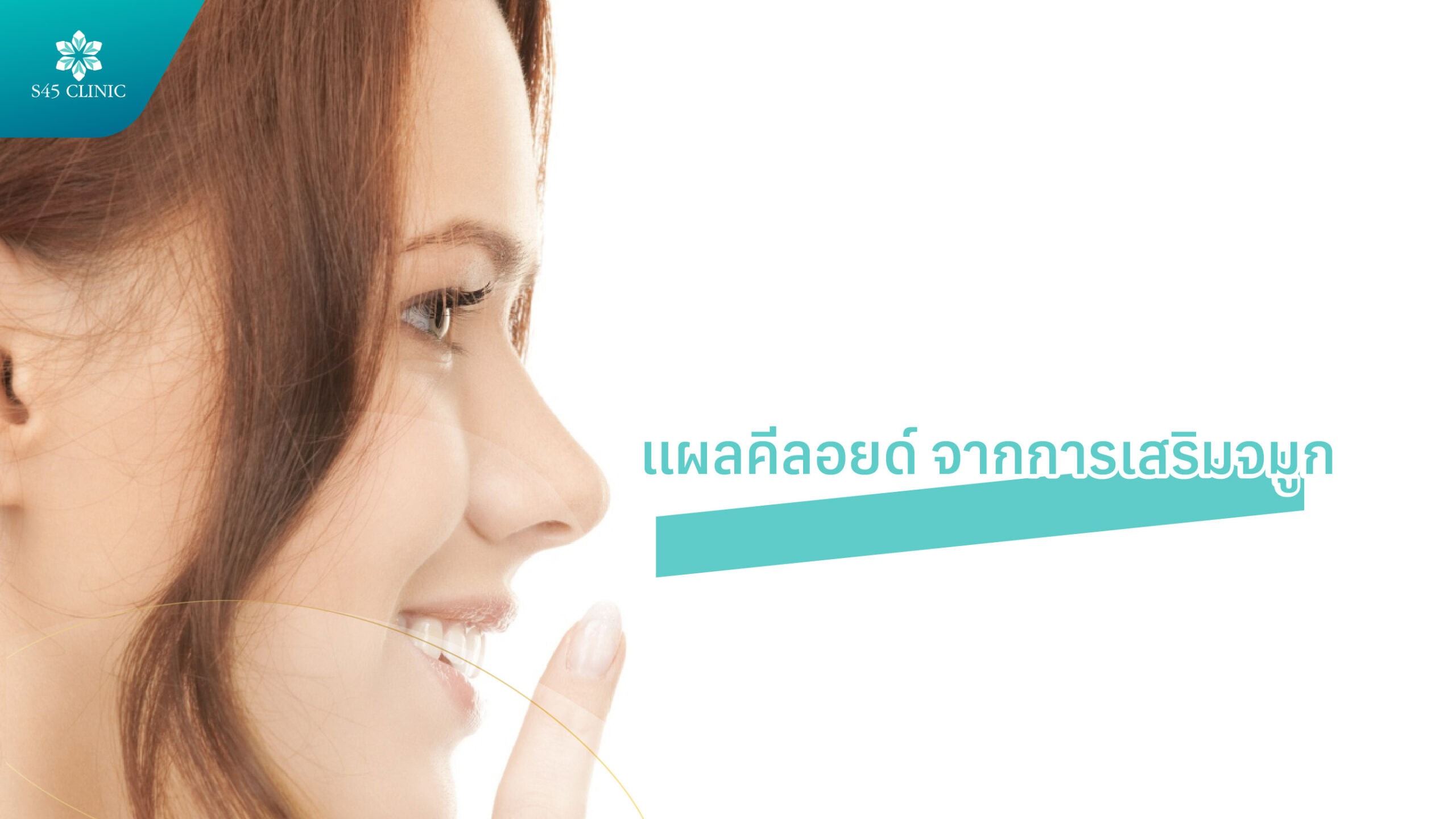 แผลคีลอยด์รักษายังไง