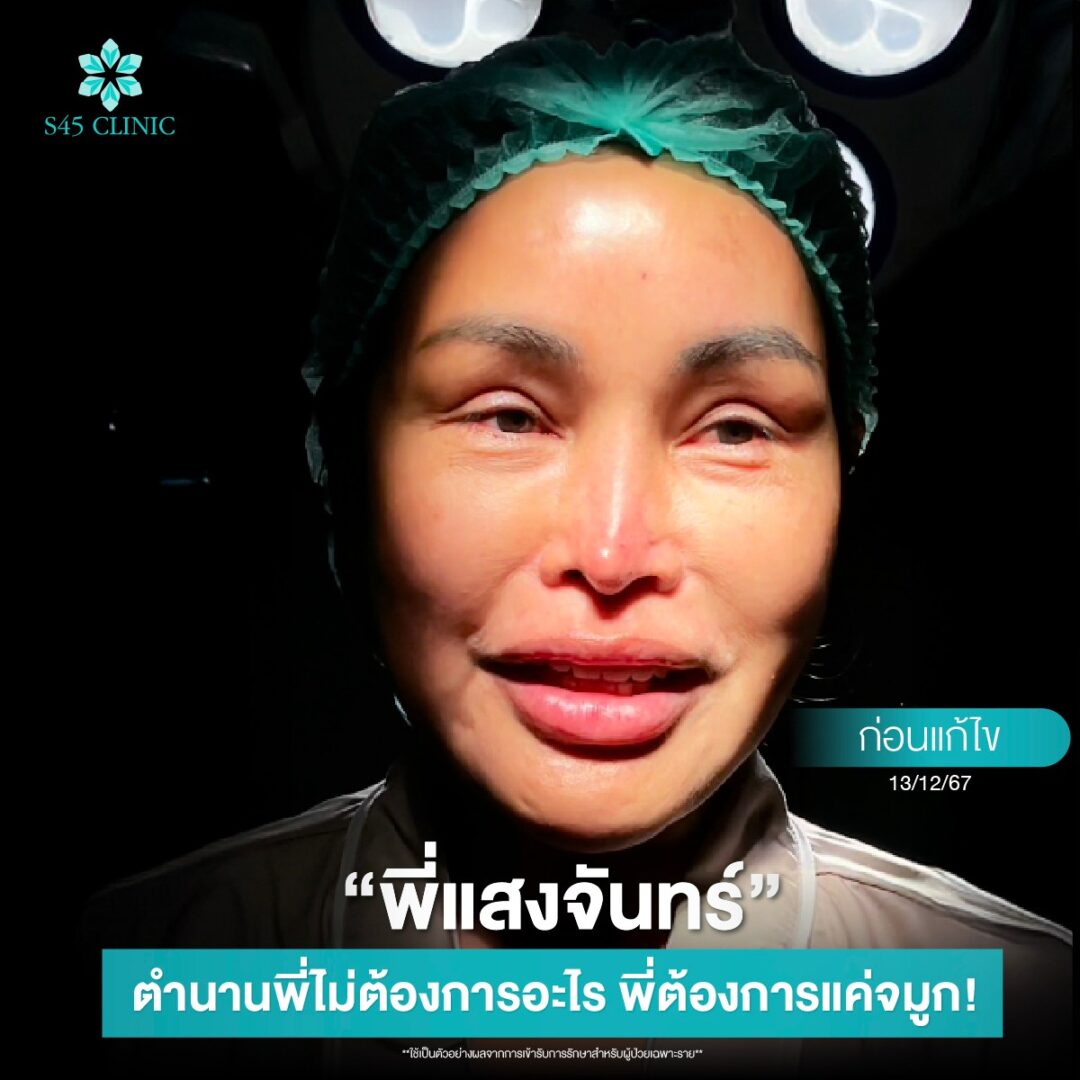 review พี่แสงจันทร์ หมอบิ๊ก
