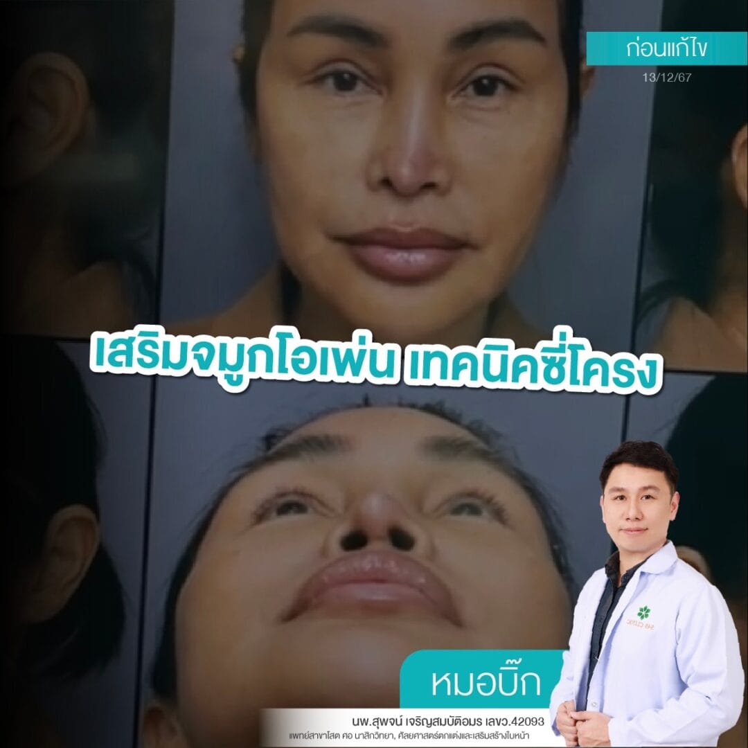 review พี่แสงจันทร์ หมอบิ๊ก2