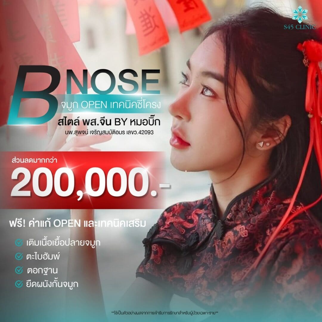 เสริมจมูก พส. จีน