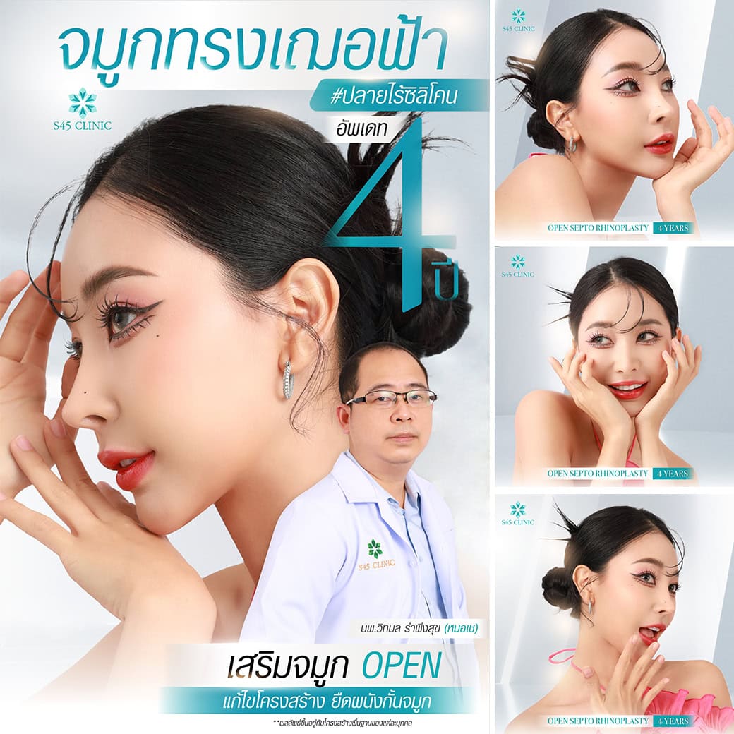 Review หมอเช