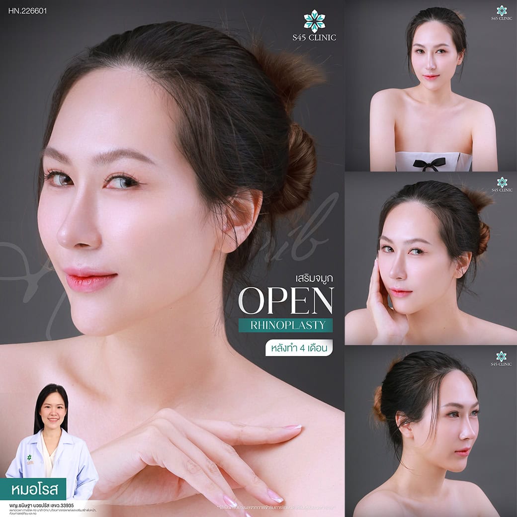 review หมอโรส