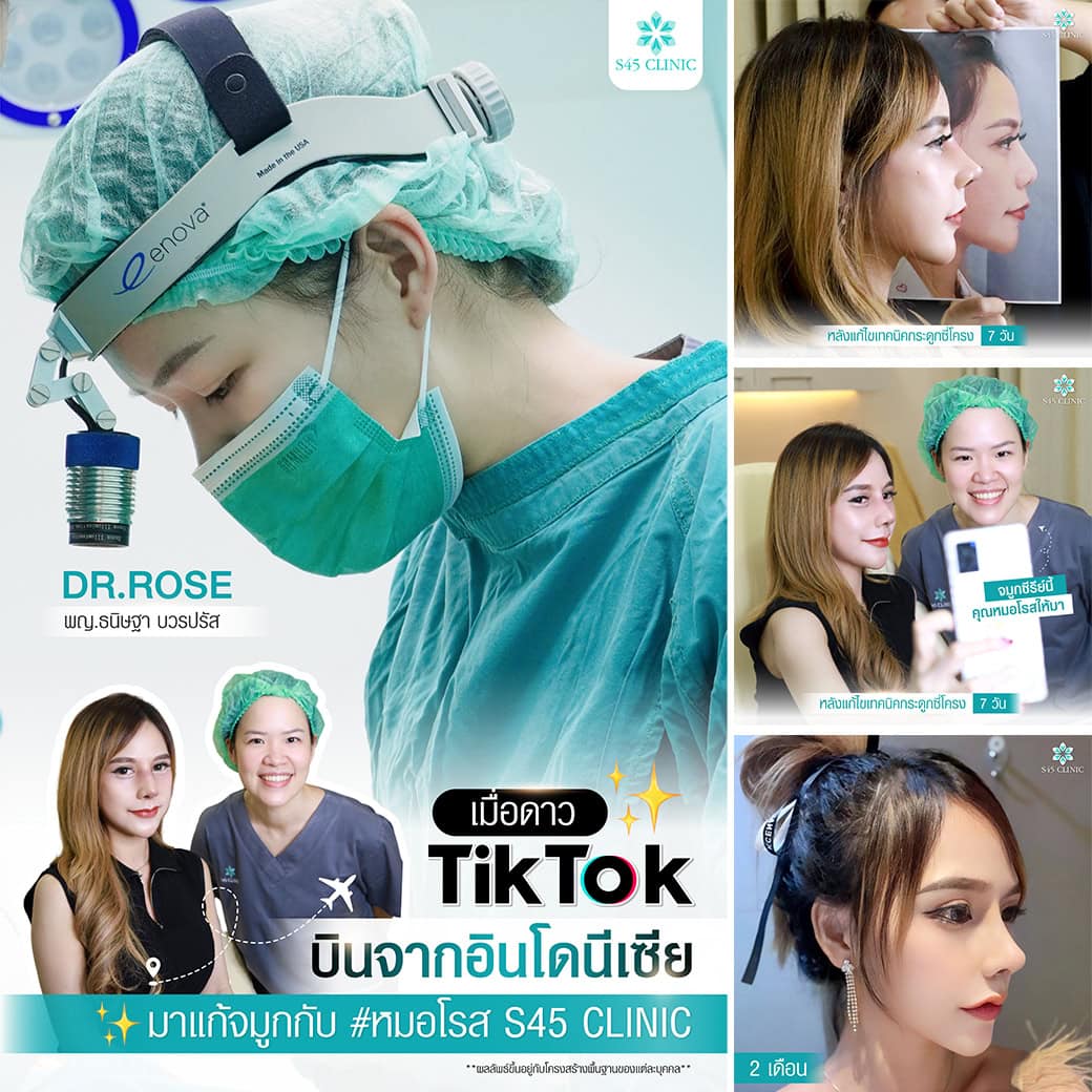 review หมอโรส