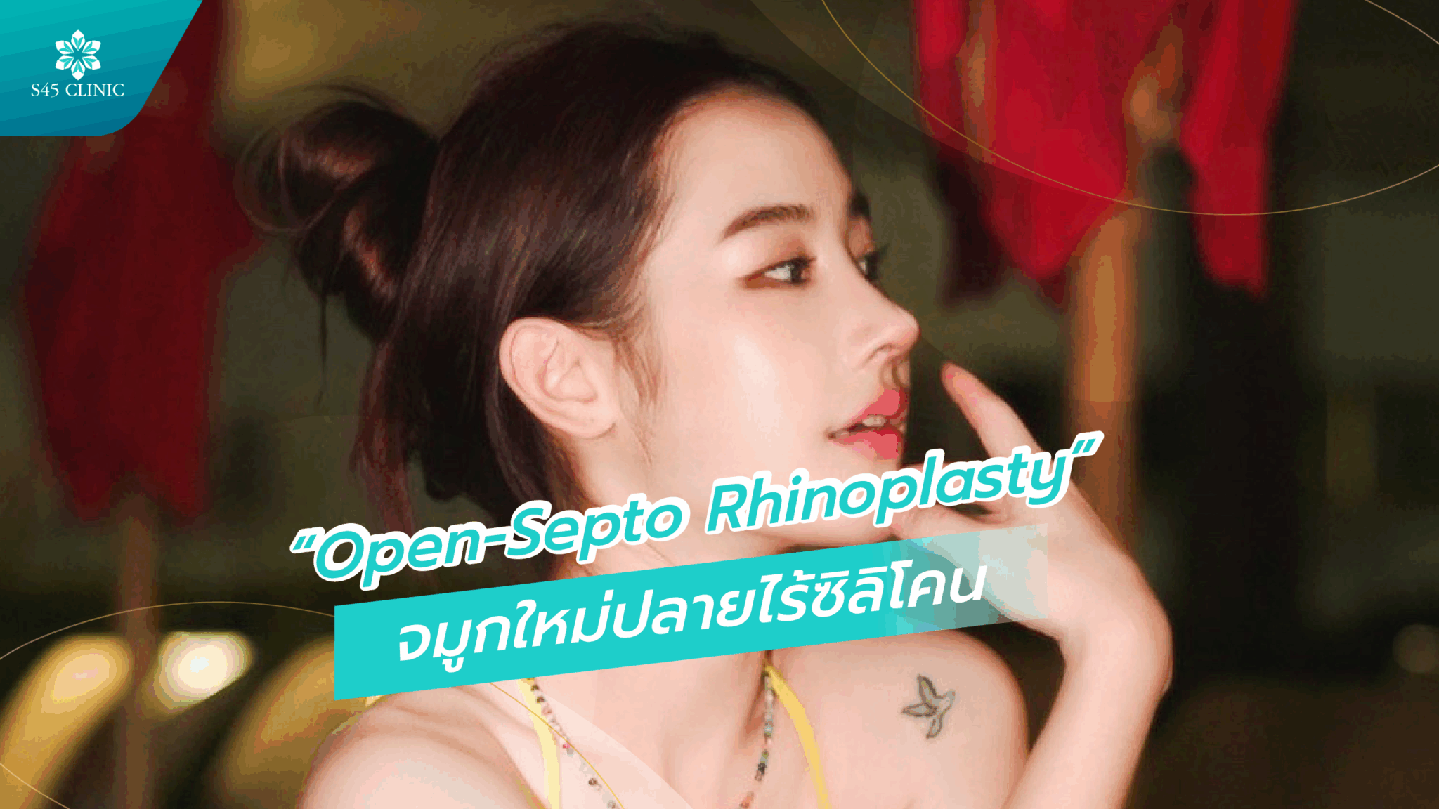 เสริมจมูก Open-Septo Rhinoplasty