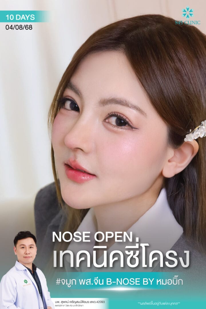 b-nose หมอบิ๊ก