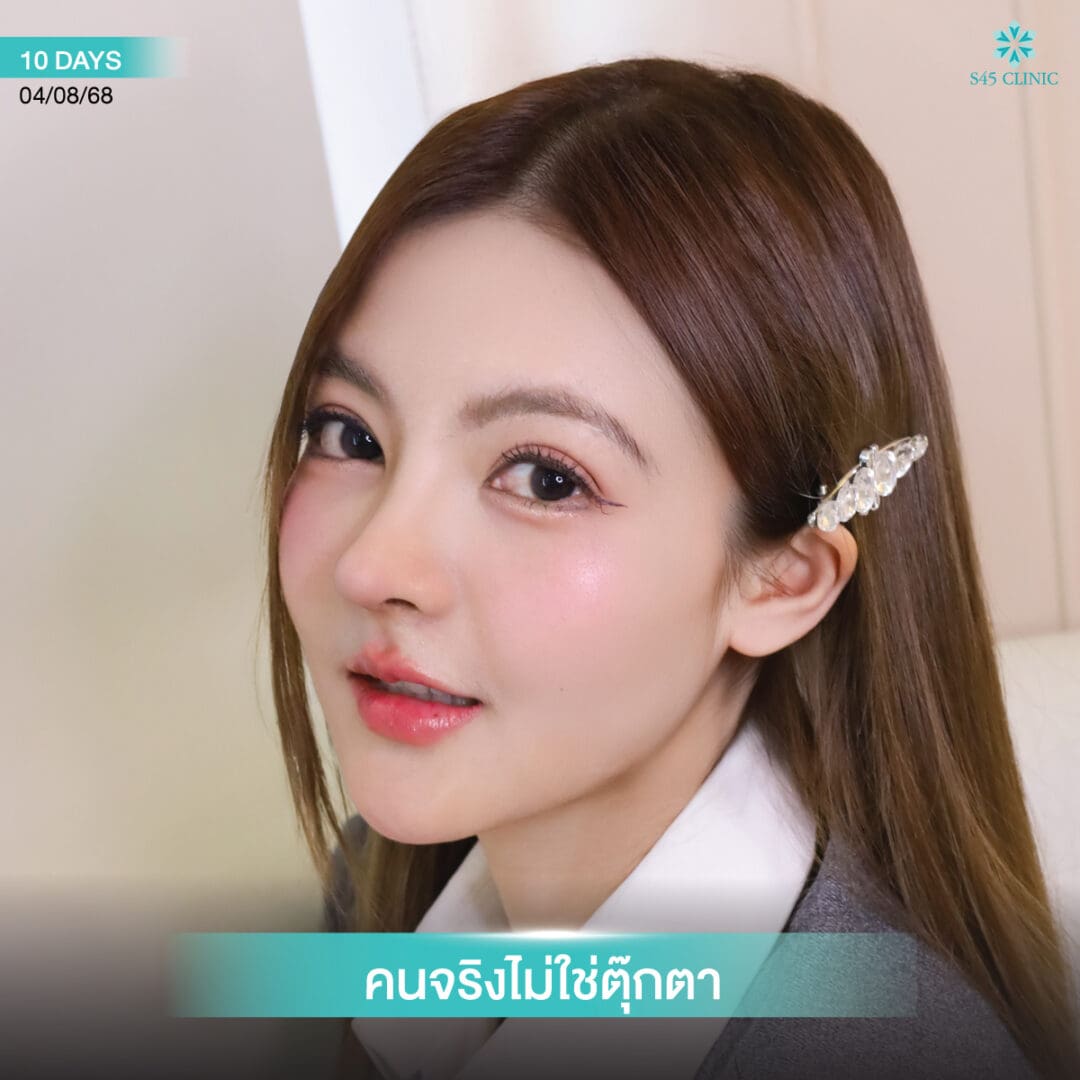 b-nose หมอบิ๊ก