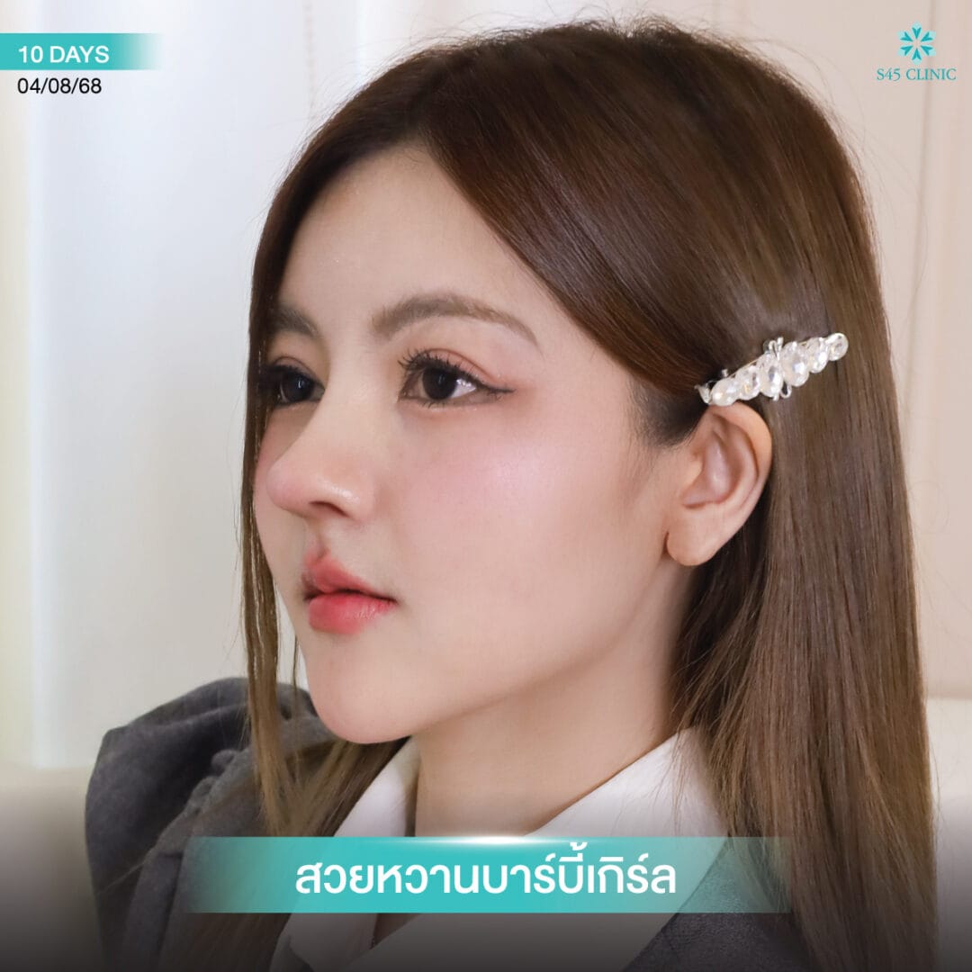 b-nose หมอบิ๊ก