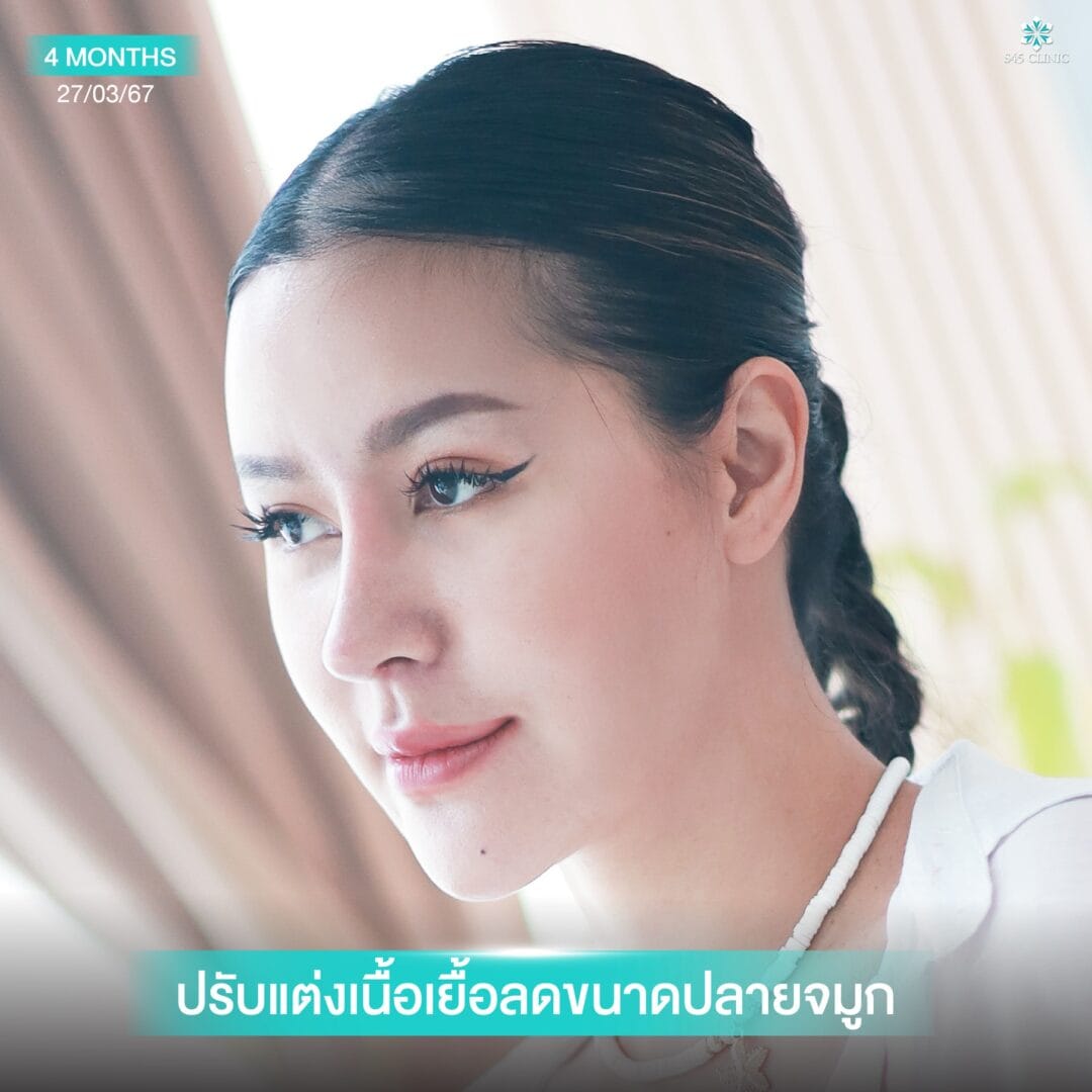 จมูกทรงตุรกี หมอจอร์เจีย