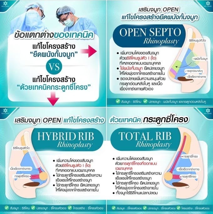 ความแตกต่างของเทคนิคเสริมจมูก open