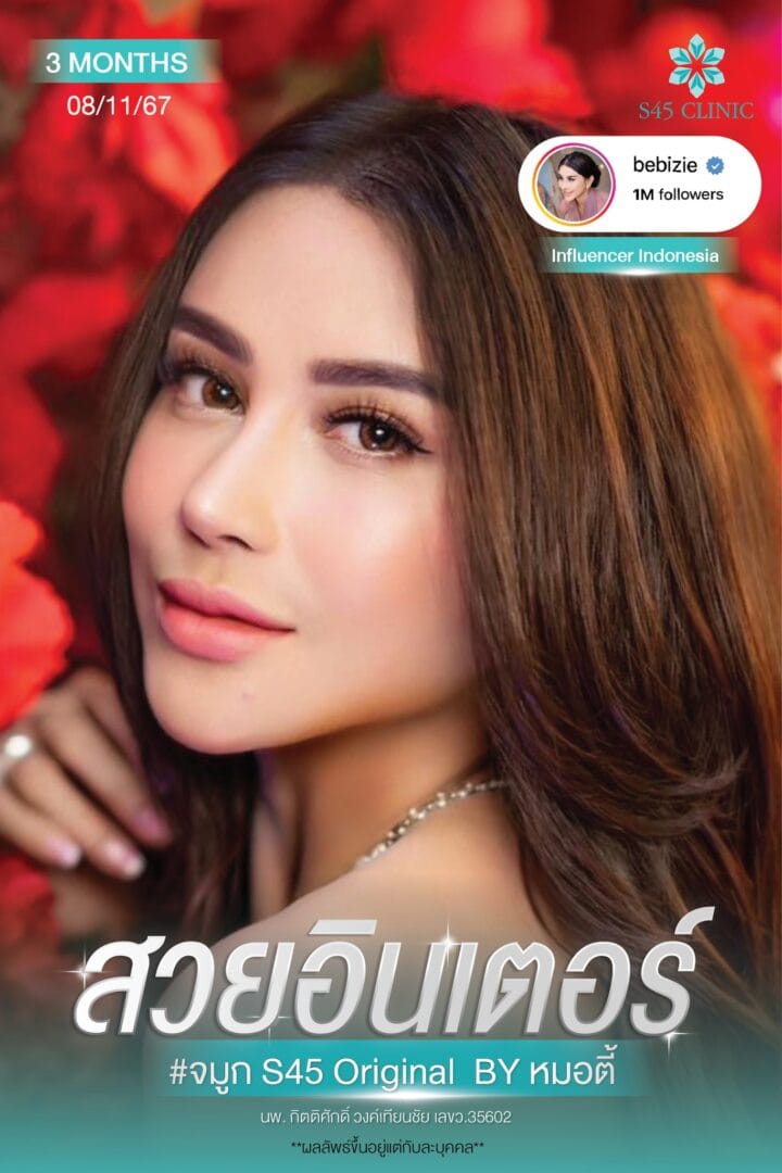 เสริมจมูก หมอตี้