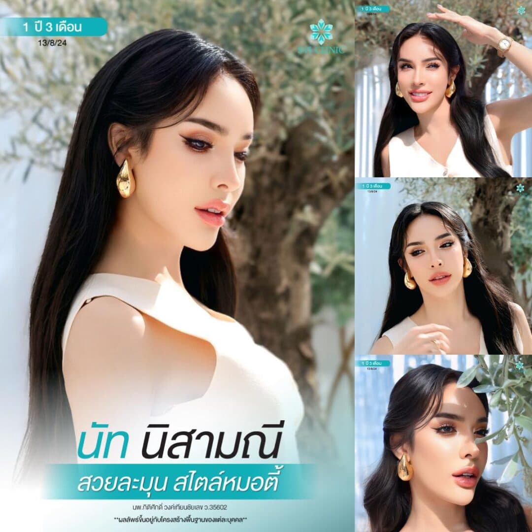 แก้จมูก หมอตี้ S45 Original