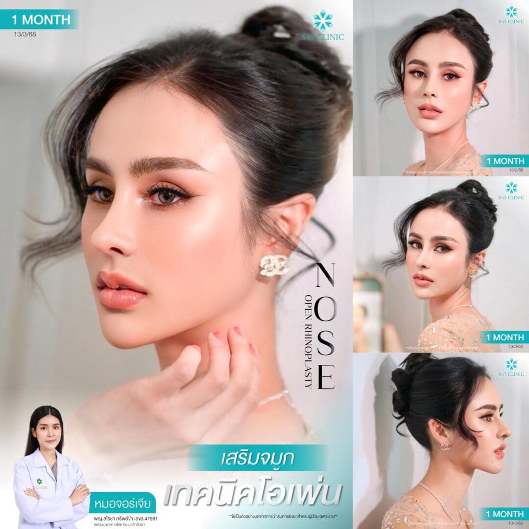 ทรงจมูก B-Nose หมอบิ๊ก
