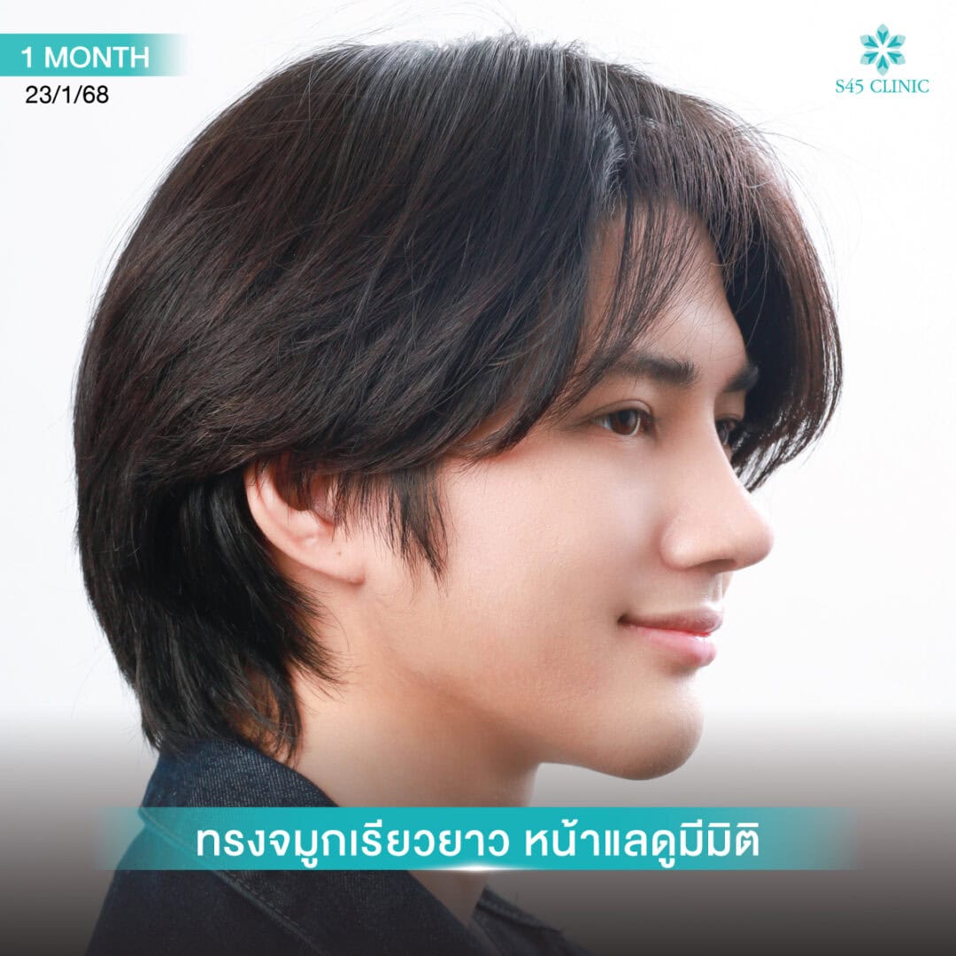 ทรงจมูกผู้ชาย