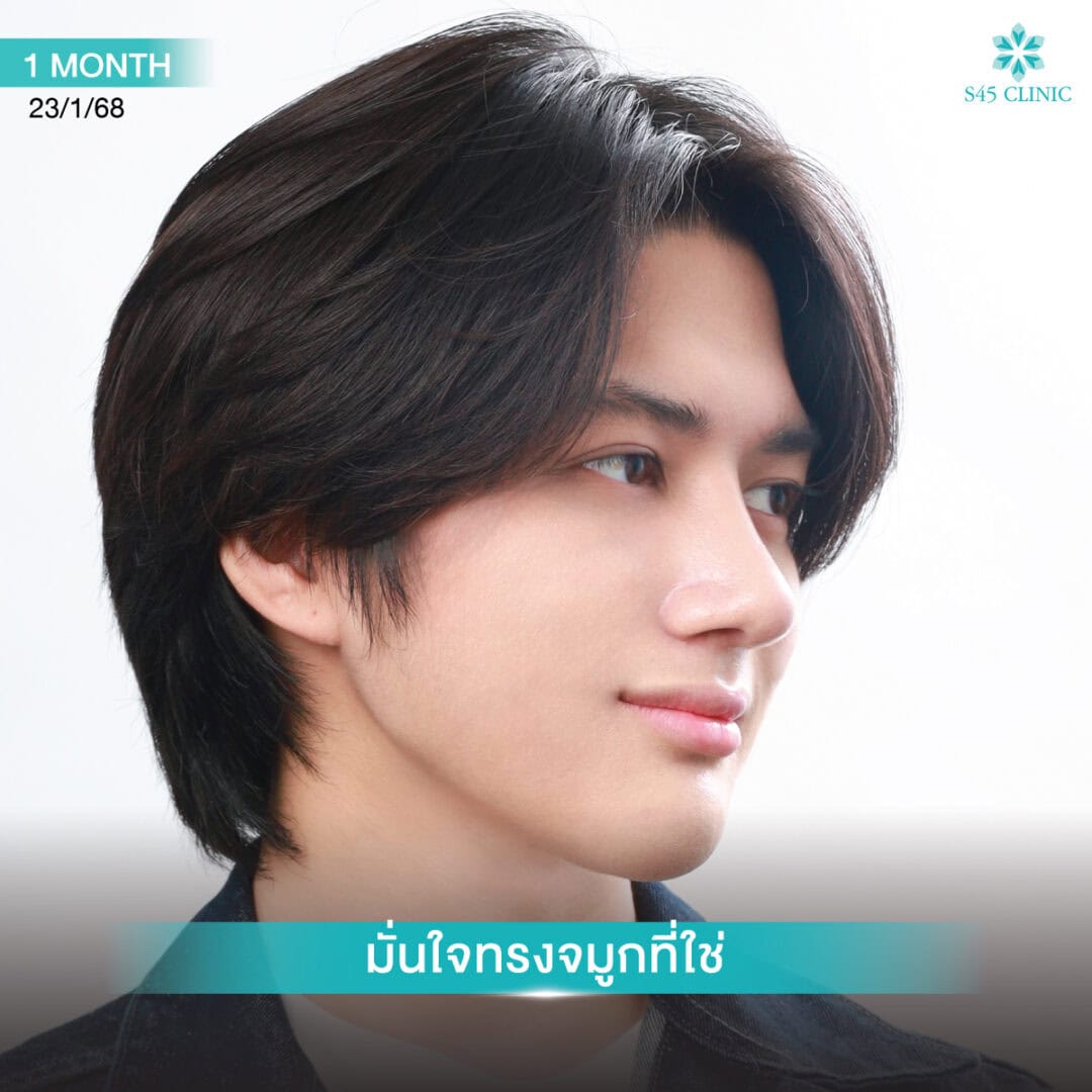 ทรงจมูกผู้ชาย